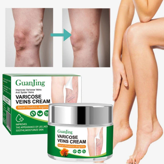 crema para varices