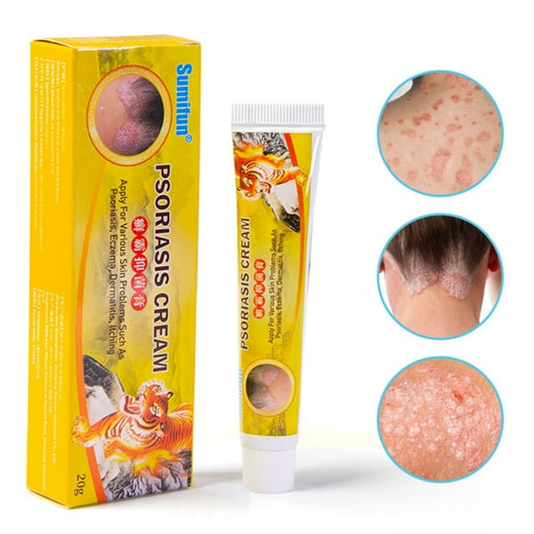 Crema para la psoriasis