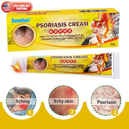 Crema para la psoriasis